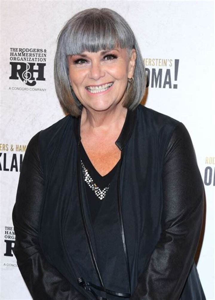
Dawn French Plastic Surgery Before And After: Does She Have Cancer? 
