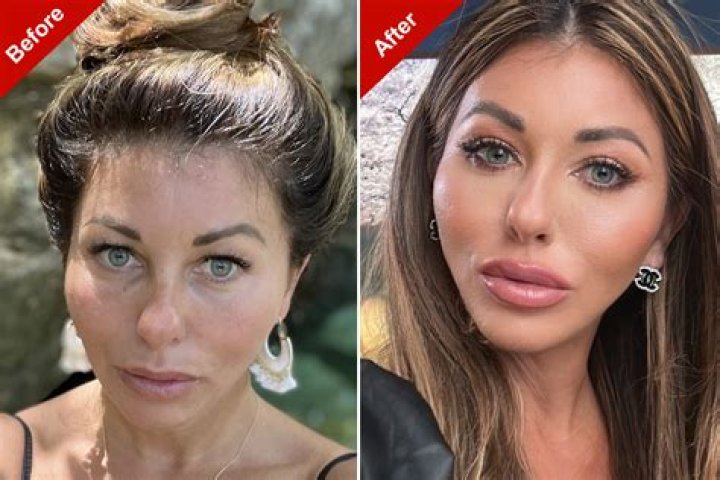 Did Holly Sonders Have Plastic Surgery Done? Fans Are Curious About The Golfer As She Gets More Popular