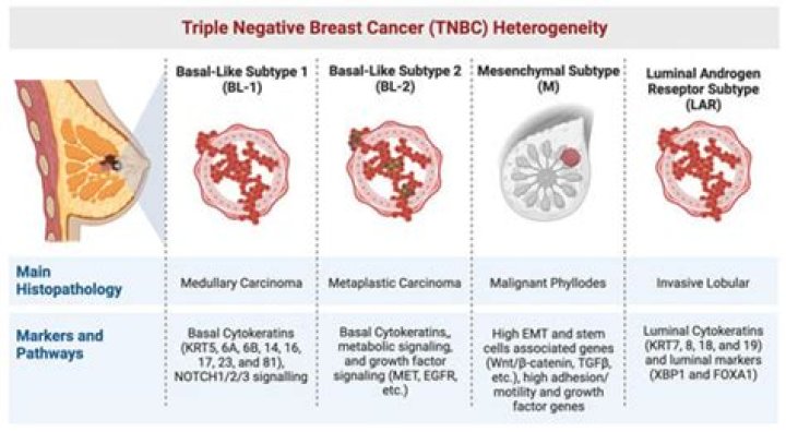 
IIT team identifies proteins that can help predict metastatic breast cancer 